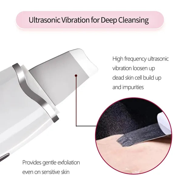 The Polish Instrument sonic facial skin scrubber by Vigiva — view 3