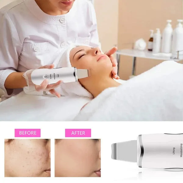 The Polish Instrument sonic facial skin scrubber by Vigiva — view 5